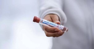 Δωρεάν rapid tests την Τετάρτη σε Καπαρέλλι και Δομβραίνα και την Παρασκευή στη Θήβα