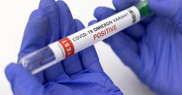 Που και πότε θα γίνουν rapid test στο Δήμο Χαλκιδέων αυτή τη βδομάδα