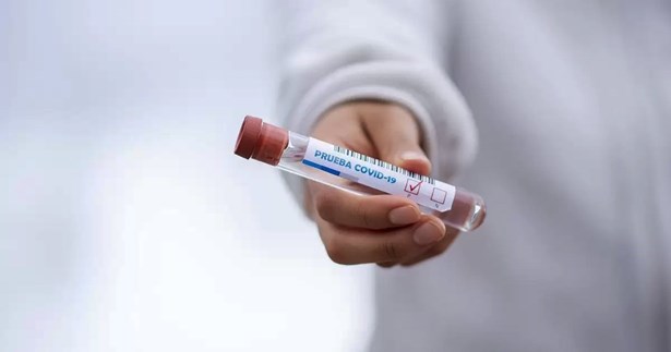 Τι έδειξαν τα γρήγορα τεστ κορωνοϊού της Δευτέρας στη Στερεά Ελλάδα