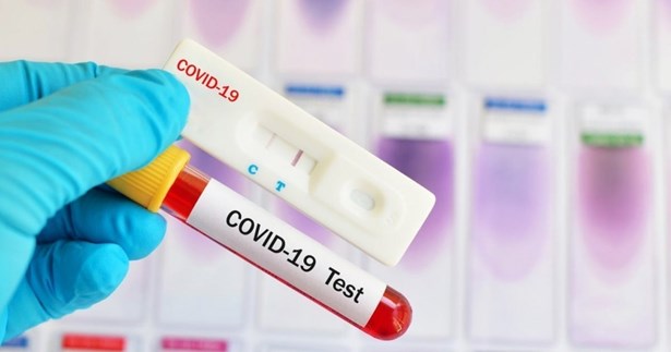 Τι έδειξαν τα γρήγορα τεστ κορωνοϊού της Δευτέρας στη Στερεά