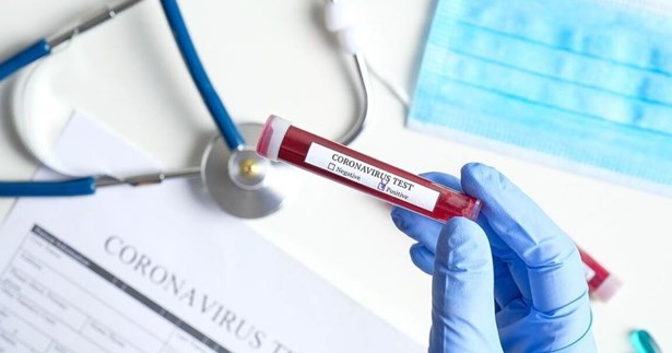 Τι έδειξαν τα γρήγορα τεστ της Τρίτης στη Στερεά Ελλάδα