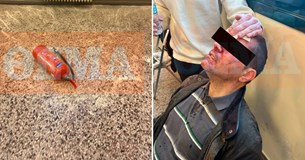 «Τελειώσατε τώρα» φώναζαν οι κουκουλοφόροι που χτύπησαν με πυροσβεστήρα διδακτορικό φοιτητή σε εκδήλωση στη Νομική